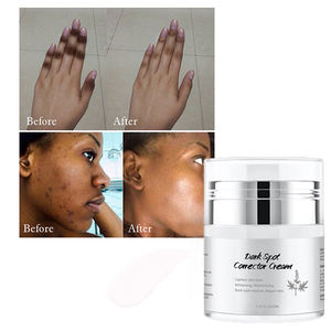 OEM/ODM高品質のライトニングスキンを出荷する準備ができてニキビのしわを取り除くダークスポットホワイトニングクリームダークスポット除去クリーム - Product Image 1