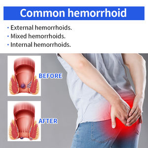 Krim Penjual Terbaik untuk Wasir Ekstrak Alami Cina Salep Alami untuk Wasir - Product Image 4