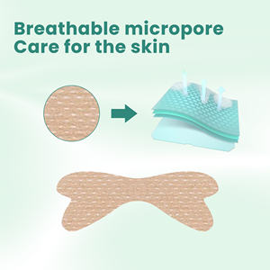 Pegatinas de corrección de uñas para prevenir hierbas baratas de fábrica con efecto de larga duración, yeso chino - Product Image 3