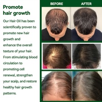 Chinaherbs Sérum de croissance capillaire naturel personnalisé, vente chaude, huile essentielle anti-chute de cheveux pour réparer les cheveux