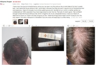 Dropshipping Sample Machine de traitement de la perte de cheveux Huile de croissance des cheveux naturels Spray de croissance des cheveux de marque privée