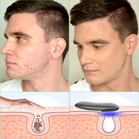 Brosse de nettoyage du visage Silicone ultrasonique Mini brosse ionique de nettoyage du visage Usb masseur Machine à laver 2020