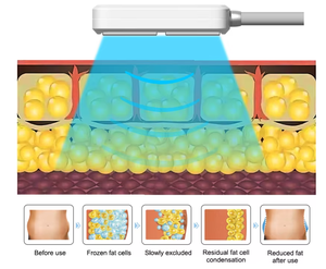 Nouveauté : Machine d'analyse de la peau du visage C9 Cryoskin, scanner professionnel de la peau du visage pour les spas, salons de beauté, réduction de la cellulite - Product Image 5