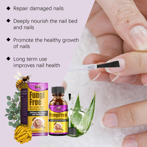 Remedio de hongos para uñas totalmente natural, Limpieza Profunda, nutre, cuidado de los pies antifúngico eficaz, novedad de 2025 - Product Image 5