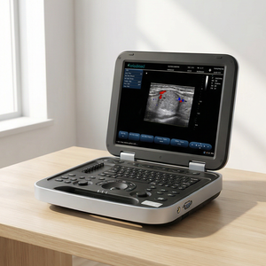 Groothandel goedkoopste kleuren Doppler draagbare echografiemachine 15 inch LCD-scherm laptop echografie scanner voor huisdieren of mensen - Product Image 5