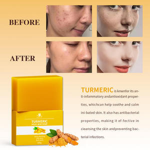 Оптовая продажа, глубокое очищение темных пятен для лица, Удаление прыщей, свечение, отбеливание гладкой кожи, ручная работа, мыло с куркумой - Product Image 5