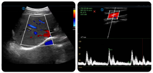 Vente directe d'usine, sonde d'échographie vétérinaire portable multifonctionnelle, utilisation animale, échographie de la tête, sans fil, VENTE CHAUDE - Product Image 3