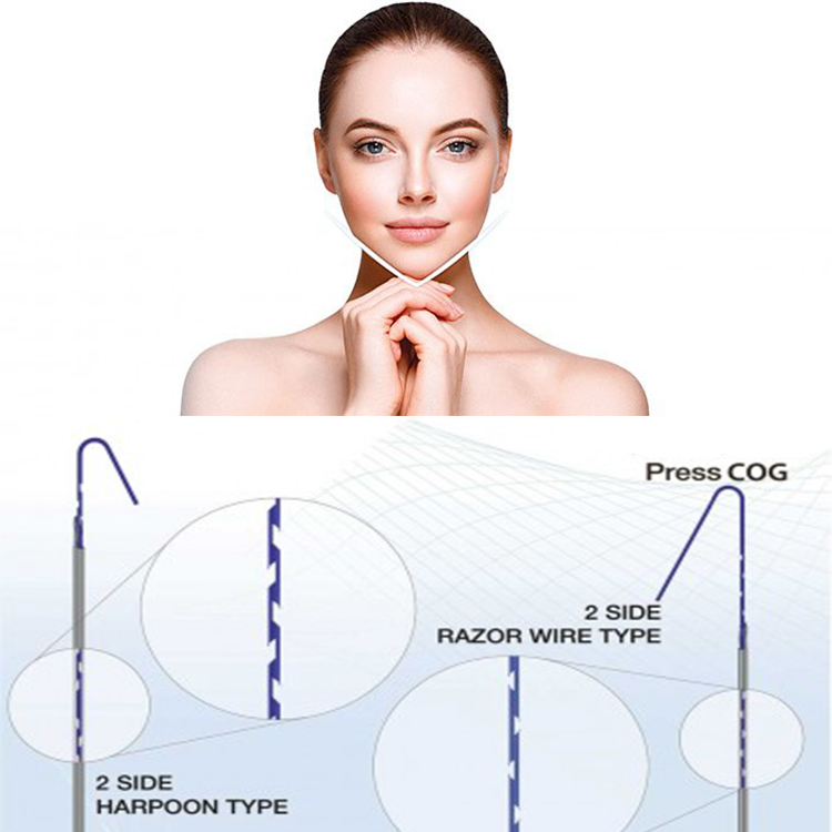 absorbable molding cog 18g L blunt 100mm pdo thread cannula Facial lift lasts long antiaging