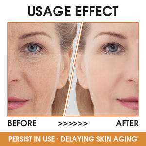 Krim Wajah pemutih Korea, krim wajah Vitamin C, Pelembab, bebas nutrisi, asam Hyaluronic, Krim nutrisi, krim wajah untuk noda hitam - Product Image 5