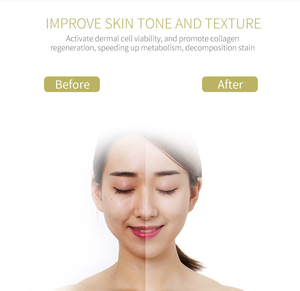 Beauty Device Facial <b>Massager</b> Whitening Skin Care Product Wholesale Price Multifunction Portable <b>Face</b> Massage - Product Image 5