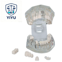 Modèle dentaire transparent d'implant dentaire, modèle de restauration de couronne et de pont amovible pour la démonstration pédagogique des dentistes