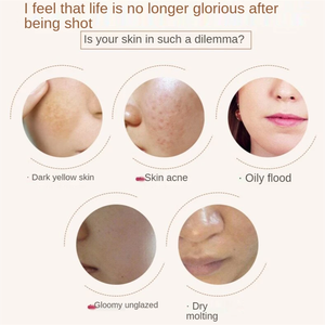 Aufhellende Gesichtscreme Beliebteste Koreanische Kosmetik Pickel Melasma Unreinheiten Entfernende Creme - Product Image 6