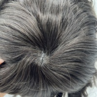 Sistem Rambut Toupee Pria 0.08mm Ultra Tipis dengan Basis Kulit, Rambut Asli India Remy untuk Pria, Pemakaian Sehari-hari, Bernapas, Tanpa Lem