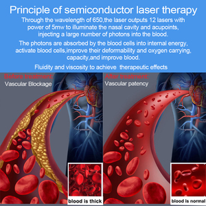 Reloj de Luz Roja de 650nm con 13 Orificios y Salida Dual para Línea Nasal, Precio de Fábrica - Product Image 5