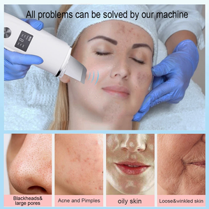 Appareil de nettoyage de la peau à micro-courant <span class=keywords><strong>4</strong></span> en 1, spatule pour le visage, extracteur de points noirs, extracteur de pores, outil de soin de la peau pour un nettoyage en profondeur du visage - Product Image 6
