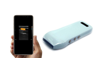 Konted MDR Sonda de ultrasonido Inalámbrico de mano Lineal Doppler Equipo electrónico C10CX MSK Vascular Thyroid Crotid - Product Image 5