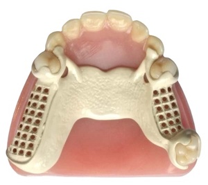 Prothese Dentaire Loại Bỏ Khung Răng Giả Một Phần Dentamura Linh Hoạt <span class=keywords><strong>PMMA</strong></span> Trống - Product Image 1