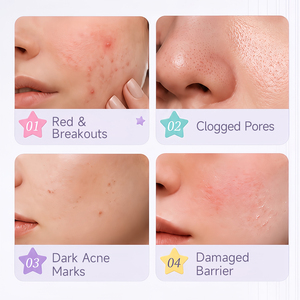 ผู้ผลิตแผ่นแปะสิว OEM แบรนด์ส่วนตัว |   แผ่นปิดสิวไฮโดรคอลลอยด์น่ารักสำหรับผิวแพ้ง่าย |   ผลิตภัณฑ์ลดรอย<span class=keywords><strong>แผล</strong></span>เป็นแบบขายส่ง - Product Image 3