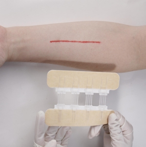 Dispositivo Médico para Cierre de Heridas, Adhesivo Quirúrgico Zip Stitch, Cierre con Cremallera, Desinfección por Infrarrojos Lejanos, Certificado CE Clase I Liderson PZF1006 - Product Image 3