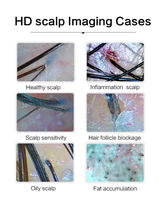 Analyseur de cuir chevelu professionnel HD UV avec grossissement 200X, microscope-scanner de follicules pileux à détection 4 spectres, modèle de bureau pour cheveux