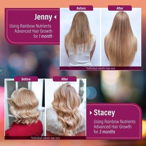 Fórmula para el Crecimiento del Cabello 24 en 1 con Biotina, Colágeno y OptiMSM en Cápsulas para Adultos - Suministro para 60 Días - Product Image 4