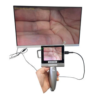 SY-P020A Venda quente Médica High-end Cirurgia Endoscópica Médica Laringoscópio Vídeo Portátil Equipamentos Médicos Reutilizáveis - Product Image 1