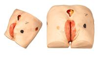 Modelo de Enseñanza de Ciencias Médicas para Úlceras por Decúbito, Modelo de Entrenamiento Médico, Maniquí de Enfermería para el Cuidado de Heridas por Decúbito, CE/ISO