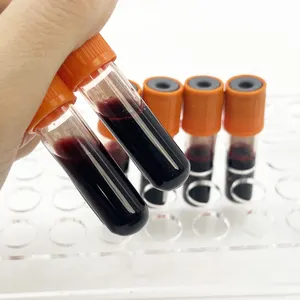 Precio de fábrica Analizador de química sanguínea Analizador de Hematología 3 partes 5 partes