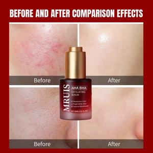 30ML di siero esfoliante per viso liquido sbiancante <span class=keywords><strong>AHA</strong></span> e BHA rivitalizzante con acido ialuronico idratante e riduce le linee sottili rinfrescanti - Product Image 4