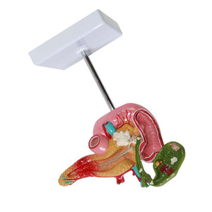 Sciedu Medical Anatomical Training Fígado Pâncreas Duodeno Modelo Patológico de modelos anatômicos da vesícula biliar - Product Image 6