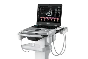Échographe Doppler Couleur <span class=keywords><strong>Portable</strong></span> 3D/4D Léger Original Mindray Z50 pour Hôpital et Échographie Prénatale - Product Image 5