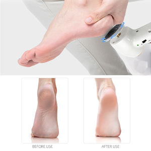 Lima Eléctrica Profesional para Pies IBelieve, Potente, Set de Manicura y Pedicura, Removedor de Callos Recargable e Inalámbrico - Product Image 2