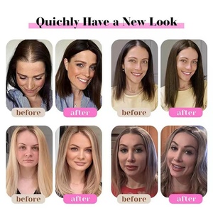 Topper de Cabello Virgen Europeo 5x7 Transpirable con Clip, Simulación de Cuero Cabelludo Natural para Reemplazo Capilar en Mujeres Blancas - Product Image 4