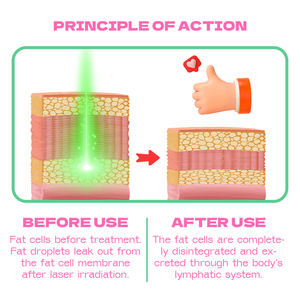 Appareil de réduction de graisse au laser Glaser indolore de pointe, lumière rouge 635nm et verte 532nm, machine amincissante corps entier, zéro temps de récupération - Product Image 6