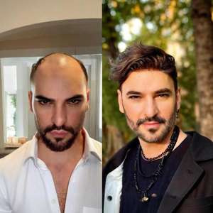 <span class=keywords><strong>Parrucchino</strong></span> TOPUNIQUE per <span class=keywords><strong>Uomo</strong></span>, Sistema di Base in Pizzo Completo Tedesco, Protesi Capillare Non Chirurgica per Uomini - Product Image 4