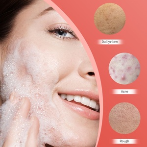 Limpiador <span class=keywords><strong>Facial</strong></span> Blanqueador con Ácido Salicílico al 0.5%, Control de Grasa, Hidratante, Reparador del Acné, Espuma Limpiadora <span class=keywords><strong>Facial</strong></span> OEM ODM con Niacinamida 150g - Product Image 2