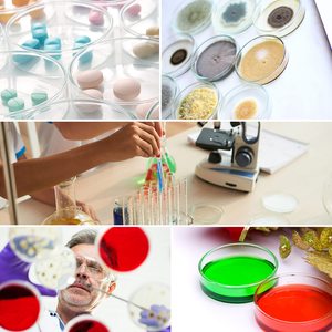 Dapat disesuaikan 100mm transparan PS plastik <span class=keywords><strong>Petri</strong></span> piring pola untuk laboratorium sel budaya dapat disesuaikan 100mm <span class=keywords><strong>Petri</strong></span> <span class=keywords><strong>dish</strong></span> - Product Image 5