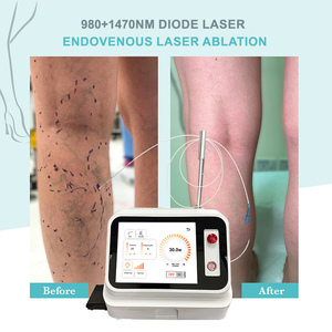 EVLT <strong>Legs</strong> Phlebology Endovenous L Ser <strong>Treatment</strong> <strong>Varicose</strong> <strong>Veins</strong> 980nm1470nm 50W <strong>Varicose</strong> <strong>Veins</strong> Removal Machine - Product Image 2