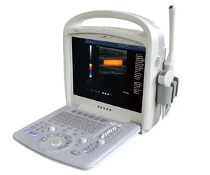 Attrezzatura medica KR-C60 macchina ad ultrasuoni portatile a colori doppler ad ultrasuoni