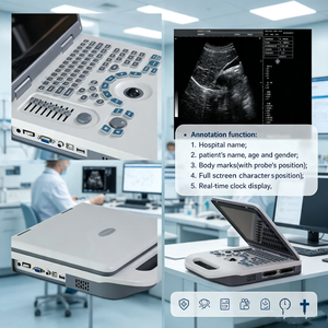 Échographe Doppler numérique 3D 4D complet sur chariot, <span class=keywords><strong>portable</strong></span>, pour usage médical humain, avec scanner intégré pour ordinateur <span class=keywords><strong>portable</strong></span> - Product Image 5