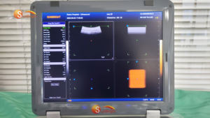 Máquina de ultrasonido veterinario 2D para Hospital, portátil de alta calidad, escáner de ecografía portátil B/W PW, ULTRASÓNICO en blanco y negro, de alta calidad, a la venta, a la venta - Product Image 4