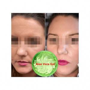 Gel d'aloe vera biologique, gel d'aloe vera à base de plantes pour le visage, le corps et les mains, apaisant et hydratant, cosmétiques, fourniture d'usine - Product Image 1