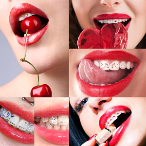 Juego de gemas dentales de diamantes de imitación de base plana con brocas, dijes de cristal para decoración de uñas y dientes DIY - Product Image 2