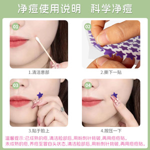 Patchs anti-acné en forme d'étoile, colorés, respirants, emballage individuel 4g pour adolescents et adultes, traitement de l'acné - Product Image 2