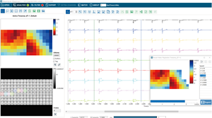 Système de cartographie électrique à 36 canaux de haute précision pour une analyse détaillée de la conduction électrique cardiaque - Product Image 6