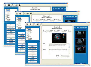 Échographe vétérinaire portable <span class=keywords><strong>3D</strong></span> couleur Doppler pour animaux de compagnie (chats, chiens) – Échographie vétérinaire de Chine - Product Image 5