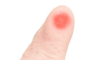 Model Pelatihan Perawatan Kaki Glycuresis Ilmu Kedokteran Model Kaki Manusia Penyakit Diabetes Kaki - Product Image 5