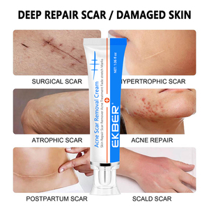Etiqueta privada, venta al por mayor, producto para el cuidado de la piel, reparación de ojeras, espinillas, crema antiacné para eliminar cicatrices, Gel reafirmante - Product Image 3