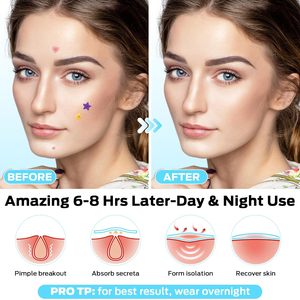 T Hydrocolloid Parches para el acné con ácido salicílico Cute Star Zit Stickers Colorful Star Blemish Covers para Face Zit Patch Acné Dots - Product Image 3