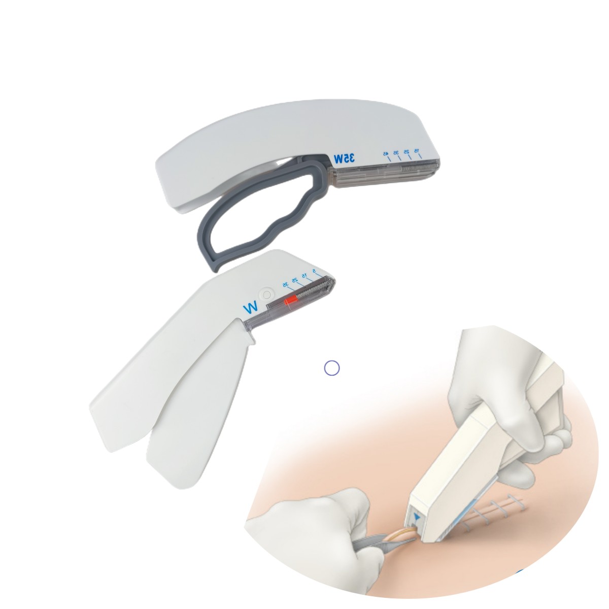 일회용 외과 피부 스테이플러 제조업체 피부 스테이플러 용 35W 멸균 스테이플 리무버 키트